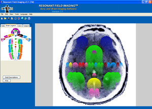 version31brain